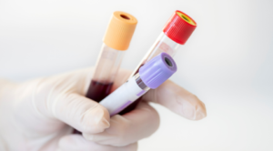 Read more about the article Jakie badania profilaktyczne powinniśmy wykonać przynajmniej raz w roku?